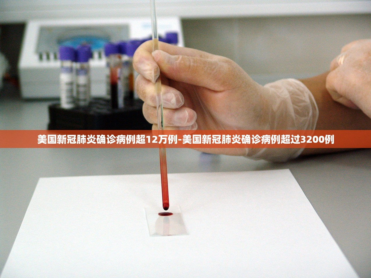美国新冠肺炎确诊病例超12万例-美国新冠肺炎确诊病例超过3200例